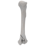 Humerus - Canine - Fracture 13-B2 acc. to AOVet