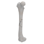 Femur - Canine - Fracture I 32-B1 acc. to AOVet