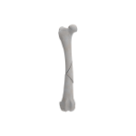 Femur - Canine - Fracture II 32-B1 acc. to AOVet