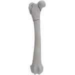 Femur - Canine - Fracture II 31-B3 acc. to AOVet