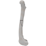 Femur - Canine - Fracture III 32-B1 acc. to AOVet