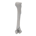 Humerus - Canine - Fracture 13-A1 acc. to AOVet