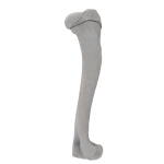 Humerus - Canine - Fracture 11-A3 acc. to AOVet