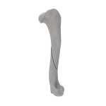Humerus - Canine - Fracture 12-A2 acc. to AOVet