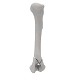Humerus - Canine - Fracture I 13-C1 acc. to AOVet (Type Y)