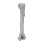 Humerus - Canine - Fracture II 13-C1 acc. to AOVet (Type T)