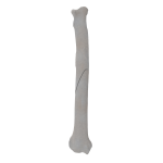 Radius - Canine - Fracture II 22-A1 acc. to AOVet