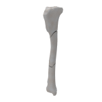 Tibia - Canine - Fracture 42-C2  acc. to AOVet