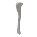 Tibia - Canine - Fracture 42-B1 acc. to AOVet