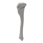 Tibia - Canine - Fracture 41-A acc. to AOVet