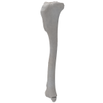 Tibia - Canine - Fracture 43-B2 acc. to AOVet