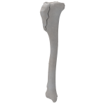 Tibia - Canine - Fracture 41-A1 acc. to AOVet