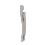 Radius and Ulna - Feline - Fracture 22-A2 acc. to AOVet 