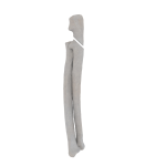 Radius and Ulna - Feline - Fracture 21-B1 acc. to AOVet