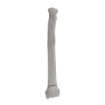 Radius - Canine - Fracture 23-A2 acc. to AOVet