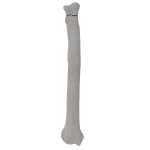 Radius - Canine - Fracture 21-A2 acc. to AOVet