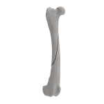 Femur - Canine - Fracture 32-A2 acc. to AOVet
