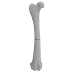 Femur - Canine - Fracture 32-A3 acc. to AOVet