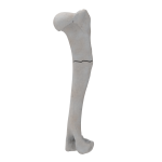 Humerus - Canine - Fracture I 12-A3 acc. to AOVet