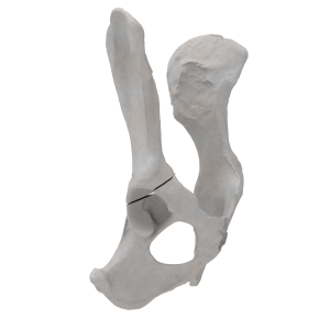 Pelvis - Canine - Acetabular Fracture II