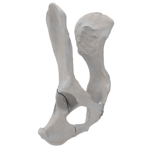 Pelvis - Canine - Oblique fracture through the caudal part of the body of the ischium and acetabulum