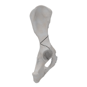 Pelvis - Canine - Multiple Fracture II