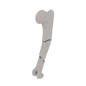 Humerus - Feline - Fracture 12-C2 acc. to AOVet 