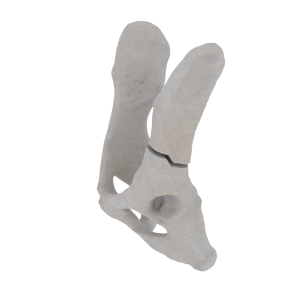 Pelvis - Feline - Ilial Body Fracture