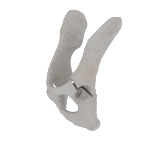 Pelvis - Feline - Acetabular Fracture I
