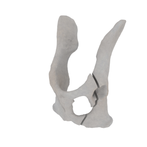 Pelvis - Feline - Oblique fracture through the cranial part of the body of the ilium and acetabulum