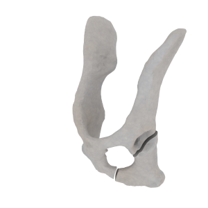 Pelvis - Feline - Oblique fracture through the caudal part of the body of the ischium and acetabulum