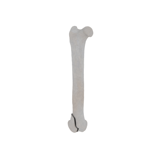 11-a2.540.png