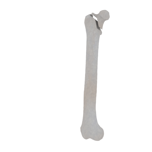 11-a2.456.png