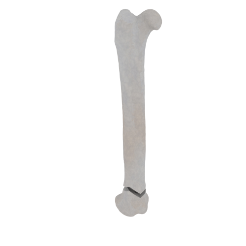 11-a2.520.png