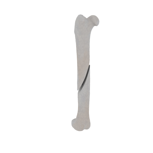 11-a2.474.png