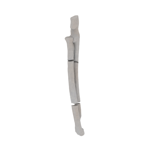 11-a2.385.png