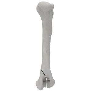 Humerus - Canine - Fracture 13-B2 acc. to AOVet