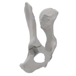 Pelvis - Canine - Acetabular Fracture I