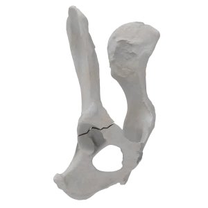 Pelvis - Canine - Acetabular Fracture I