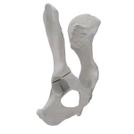 Pelvis - Canine - Acetabular Fracture II