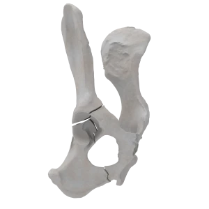 Pelvis - Canine - Acetabular Fracture (T-shape)