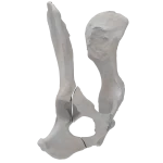 Pelvis - Canine - Oblique fracture through the cranial part of the body of the ilium and acetabulum