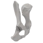 Pelvis - Canine - Oblique fracture through the caudal part of the body of the ischium and acetabulum