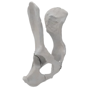 Pelvis - Canine - Oblique fracture through the caudal part of the body of the ischium and acetabulum