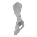 Pelvis - Canine - Multiple Fracture II