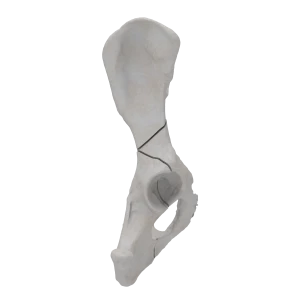 Pelvis - Canine - Multiple Fracture II
