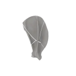 Scapula - Canine - Multifracture of scapular body