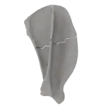 Scapula - Canine - Transverse fracture of scapular body