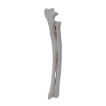 Radius and Ulna - Canine