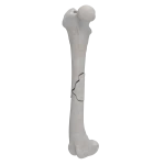 Femur - Canine - Fracture I 32-B1 acc. to AOVet